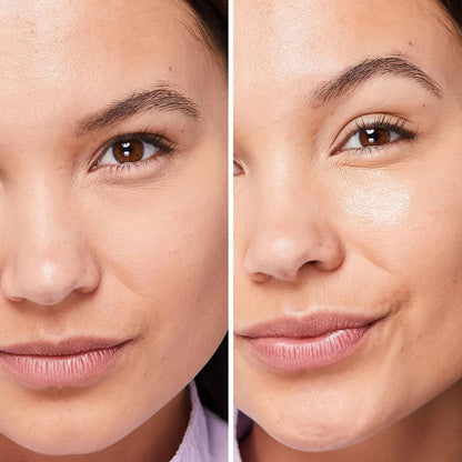 Before and after comparison of a woman's face with skin treatment effects.